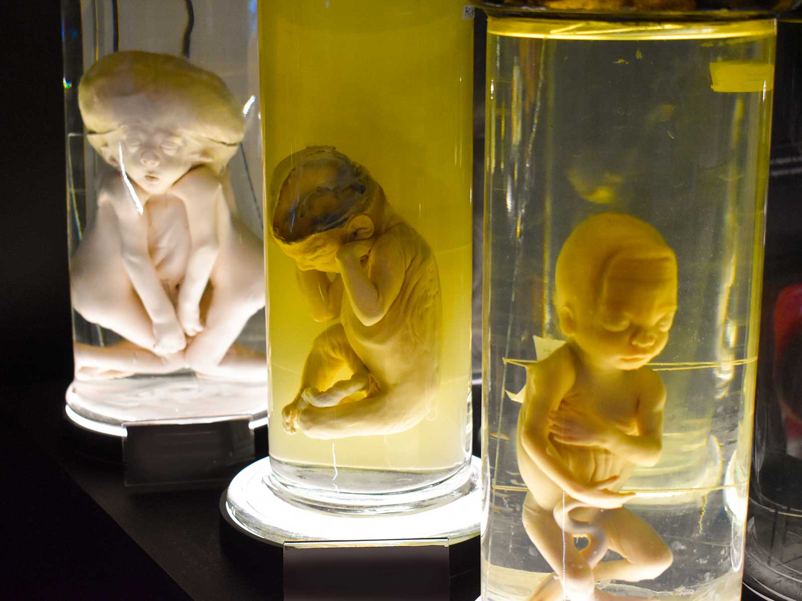 Museum of Malformations of the Human Body